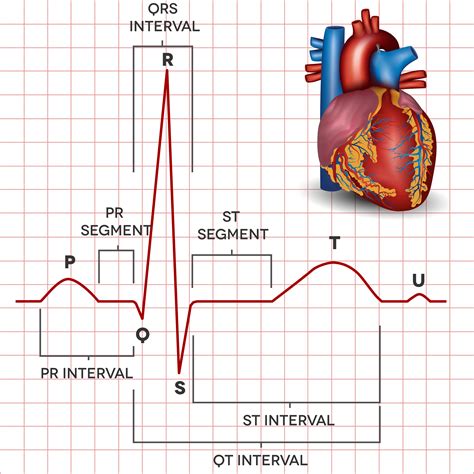 Hand Based ECG Signal に対する画像結果