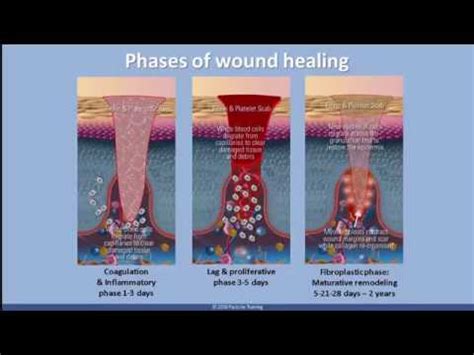 Image result for Scar Tissue Color Curve