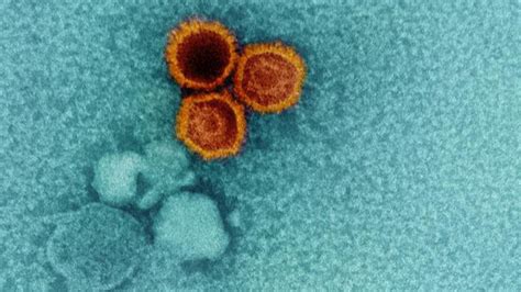Image result for EBV Virus