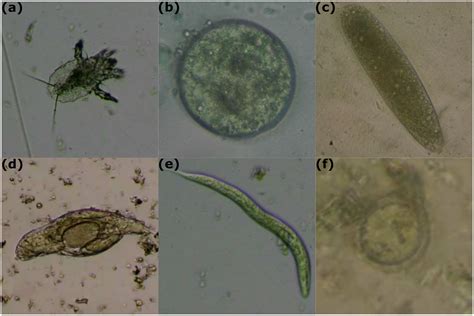 Parasitic Worm Eggs Human Stool に対する画像結果