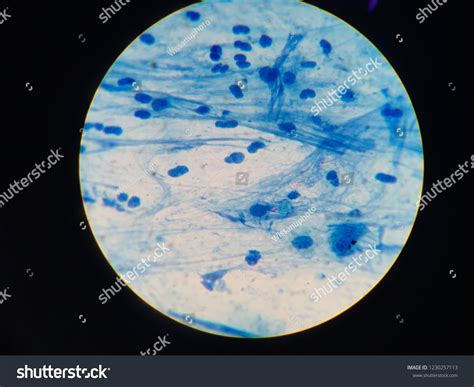 Acid-Fast Bacilli Slide Control に対する画像結果