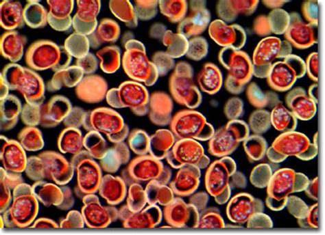 Image result for Pine Tree Pollen Under Microscope