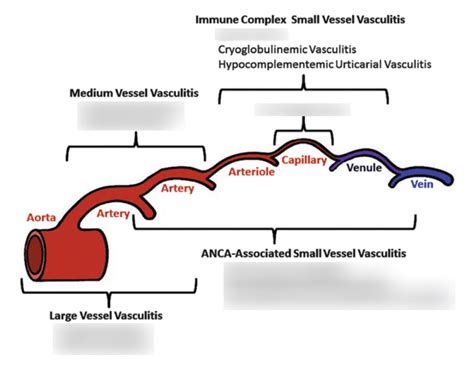 Image result for XLS Chart of Vasular Findings Quizlet