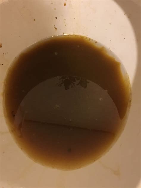 Image result for Rusty Color Diarrhea