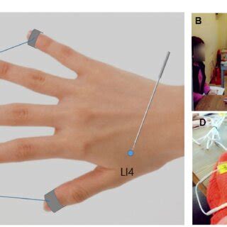 Transcutaneous Electrical Stimulation-এর ছবি ফলাফল