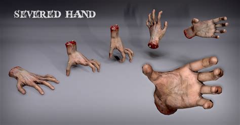 Image result for Unity Severed