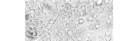 Image result for Unitron Microscope Phase Contrast Annulus