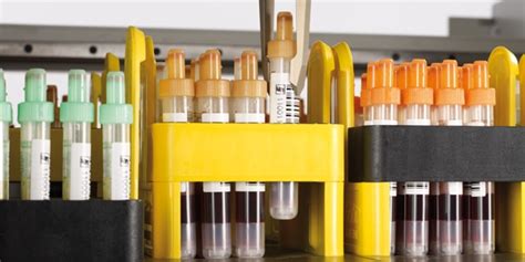 Sample Storage に対する画像結果