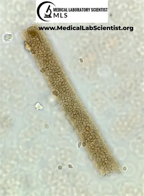 Urine Casts に対する画像結果