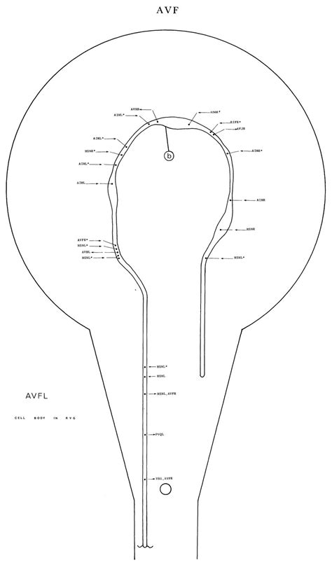 Image result for AVF Formation