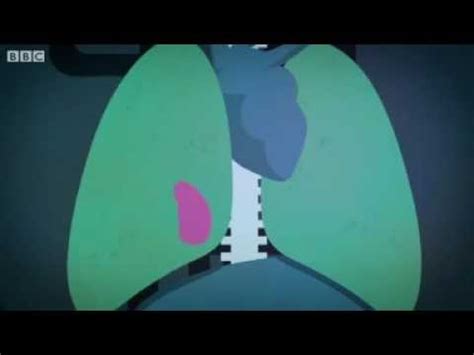 GoAnimate Cancer に対する画像結果