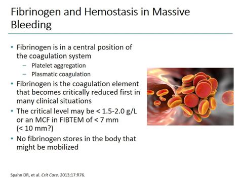 Afbeeldingsresultaten voor Trauma with Bleeding Treatment Algorithm