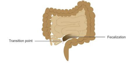 Toradh íomhá ar Obstructon Keep Left