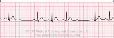 Image result for EKG Tech Practice Test
