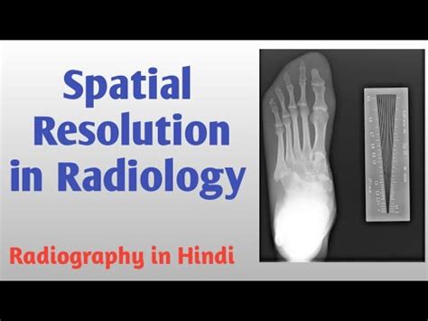 Image result for Spatial Resolution Radiography Examples