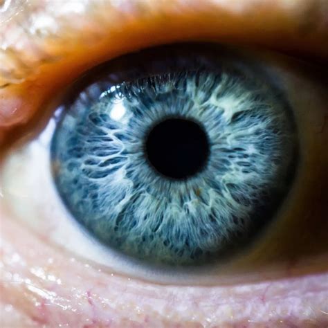 Light Blue Eyes Albinism に対する画像結果