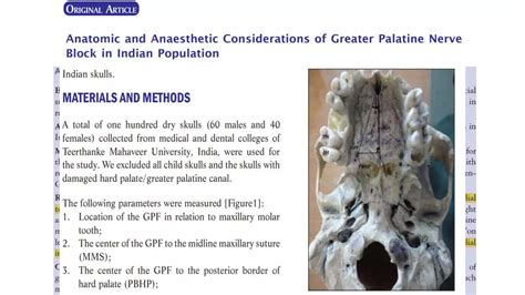 Image result for Maxillary Nerve Block