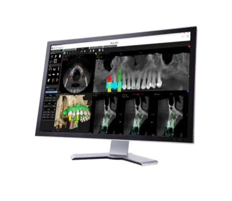Image result for Carestream 3D Imaging Software