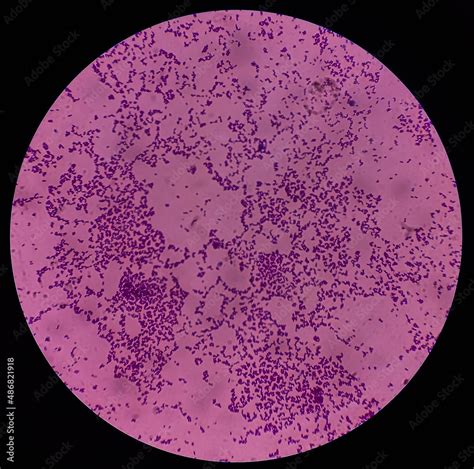 Enterococcus Gram-positive Cocci に対する画像結果