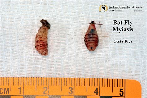 Extreme Bot Fly Removal 2016 に対する画像結果