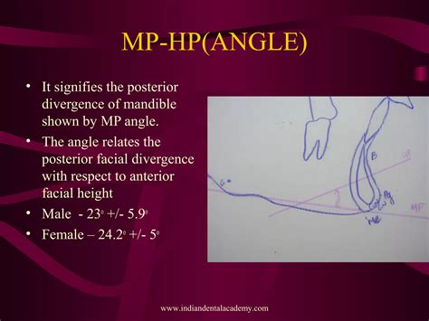 Image result for Perpendicular Cogs