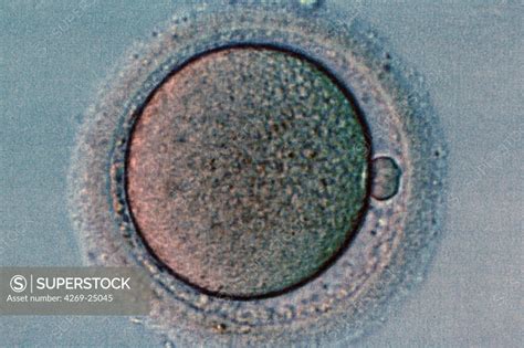 Oocyte Microscope Labeled に対する画像結果