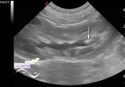 Image result for Ultrasound and Diagnostic