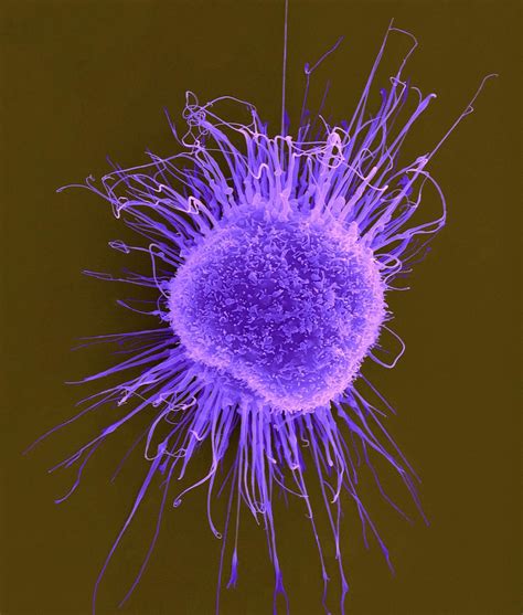 Image result for Dendritic Cells in Microscope