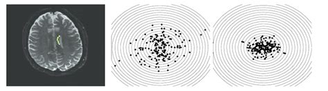 Image result for Angular Precision