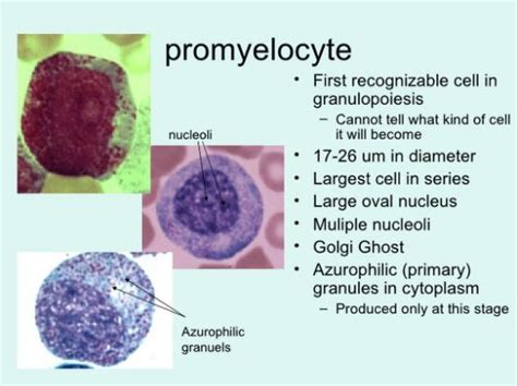 Image result for Trilobed Promyelocyte
