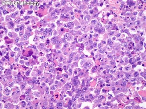 Image result for Alcl5