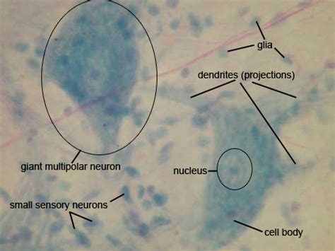 Image result for Giant Multipolar Neuron Microscope