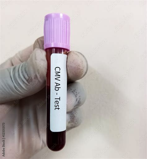 Image result for CMV Red Color Graphics