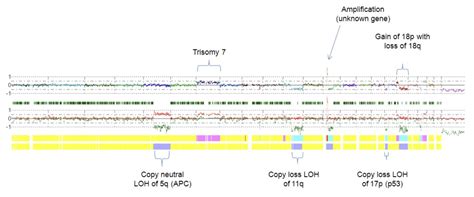 Image result for Copy Number Variation in Cancer Example