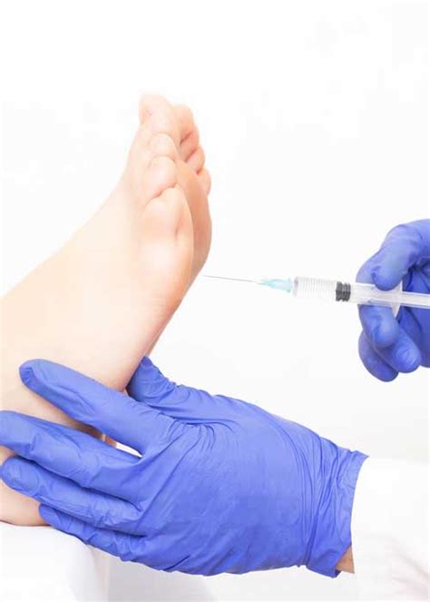 Image result for Foot Sweating Treatment