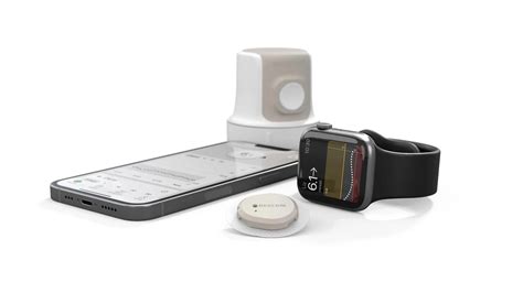 Image result for Dexcom G6 Compatible Watches