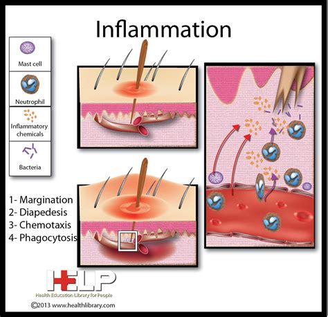 Toradh íomhá ar Inflammation Pathophysiology