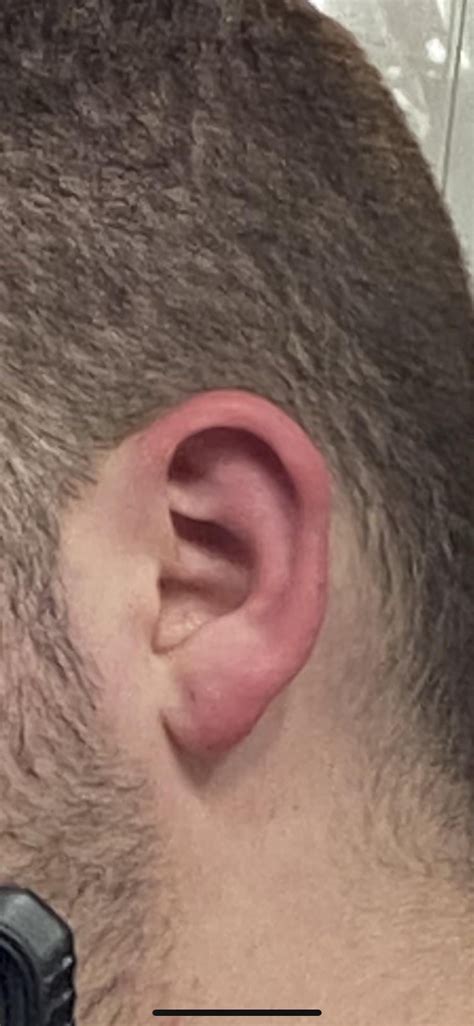 Image result for Left vs Right Ear