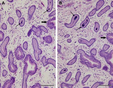 Résultat d’images pour Chicken Transcriptome