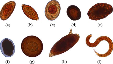 Afbeeldingsresultaten voor Types of Parasites in Human Stool
