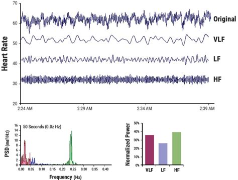 Toradh íomhá ar Heart Rate Variability Frequency Chart