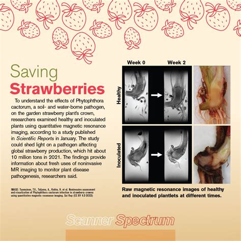 ASRT Scanner Magazine に対する画像結果