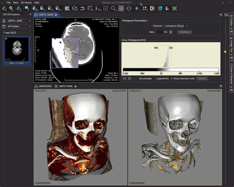 What Are Medical Imaging Software's に対する画像結果
