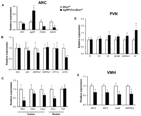 Image result for Agrp Gene Coding Region
