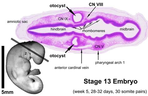 Image result for Inner Ear Embryo Development