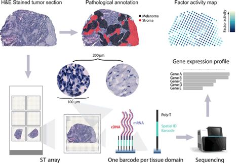 Fetal Heart Spatial Transcriptomics に対する画像結果
