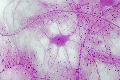 Image result for Giant Multipolar Neuron Microscope