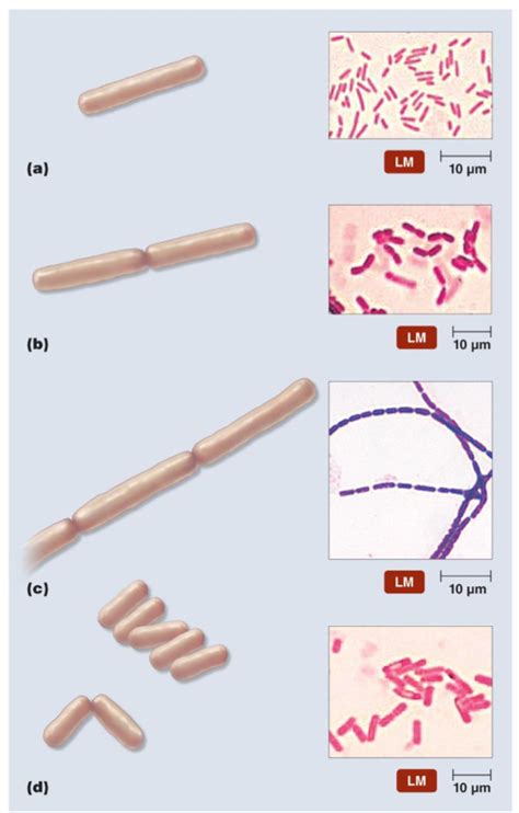 Palisading Bacilli に対する画像結果