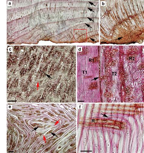 Image result for Overhang Tissue