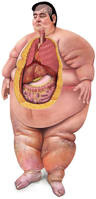 Image result for World's Heaviest Weight